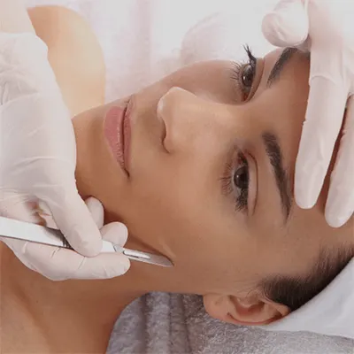 dermaplaning scottsdale