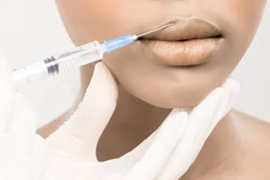 lip fillers scottsdale