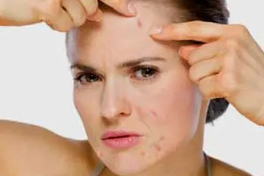 Acne Hormone Therapy Scottsdale az