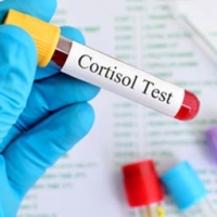 low cortisol treatment scottsdale
