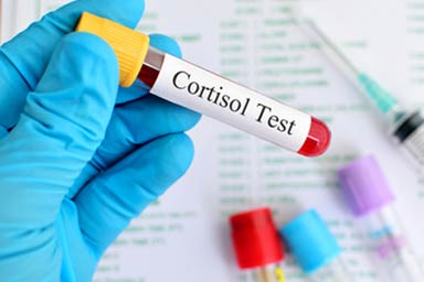 low cortisol treatment scottsdale